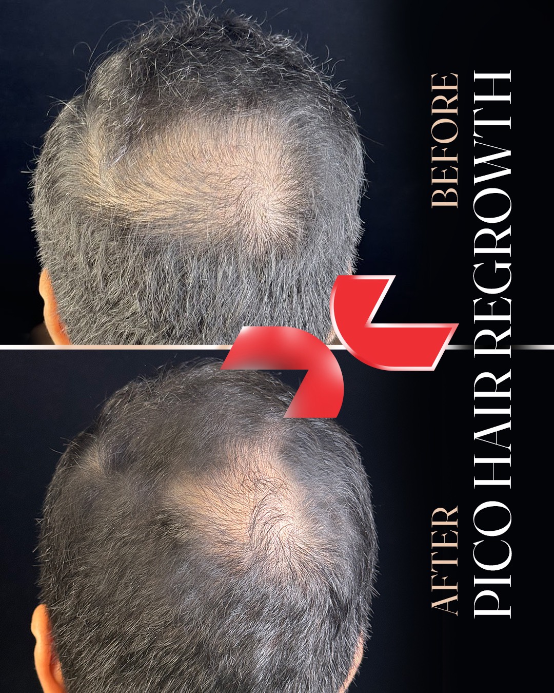 پیش‌نمایش پیکرتراشی