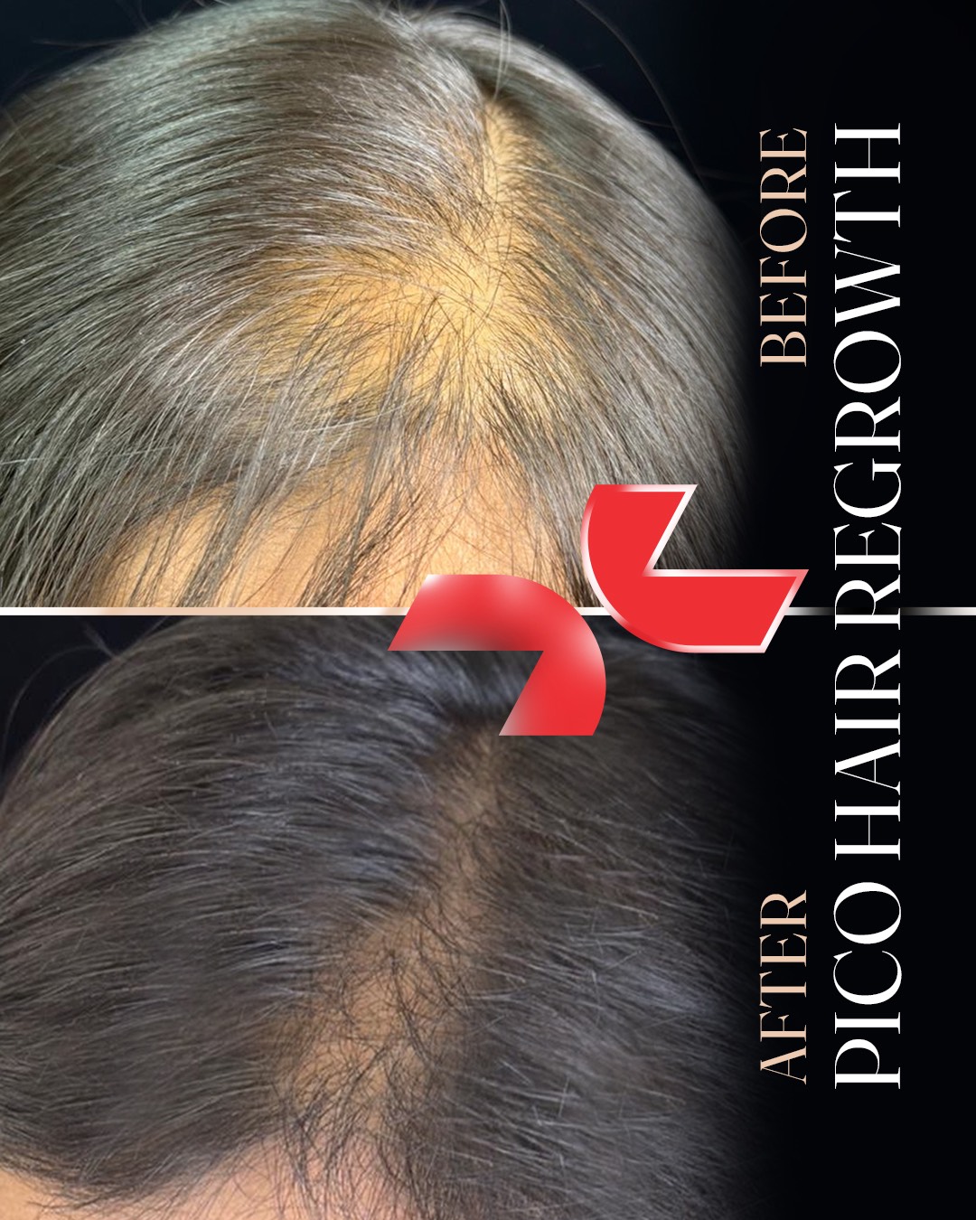 پیش‌نمایش پیکرتراشی